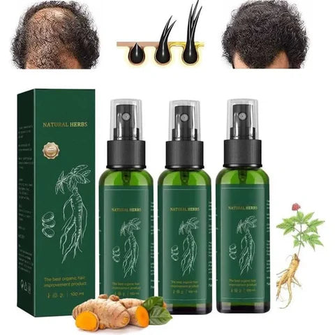 OUHOE HAIR - CRECIMIENTO DEL CABELLO🌿👨‍🦰